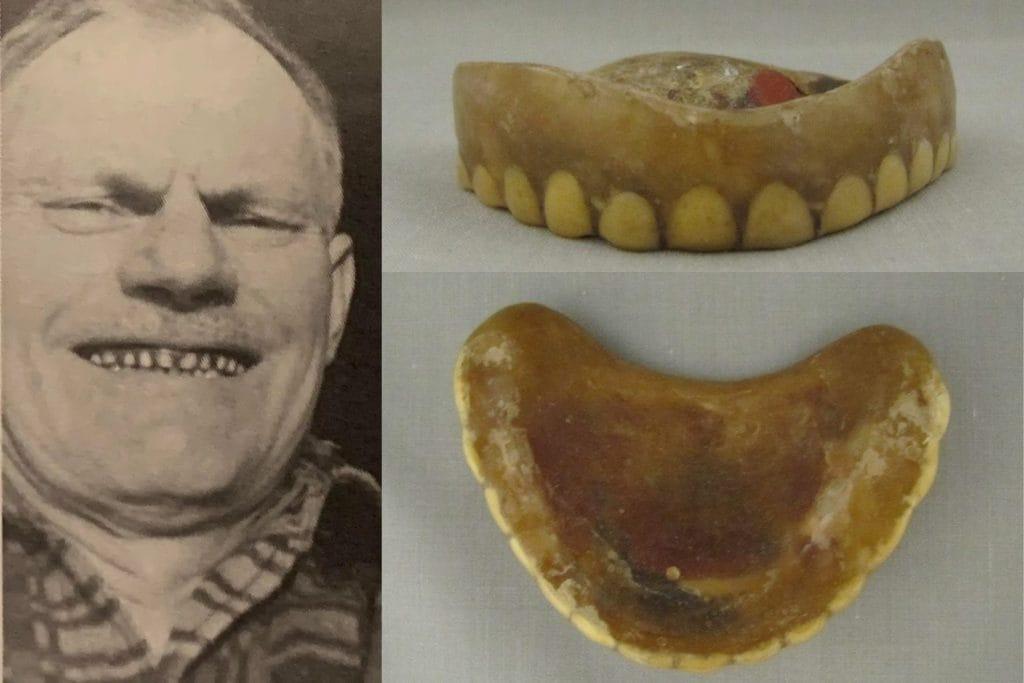 francis wharton  deer dentures